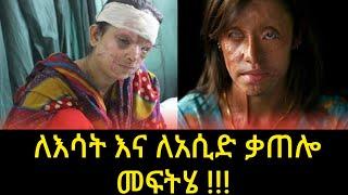 ለእሳትና አሲድ ቃጠሎ መፍትሄ ? seifu ON EBS | Abel Birhanu የወይኗ ልጅ 2 | Ethiopian music 2021| ebstv worldwide