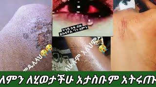 #አስደንጋጭ የወድሞቻችን ስቃይ መኖር ስለቸኝ ዛሬስ ይለያል አድሱ የሳውድ ህግ መዳሞች ደርሳቸው