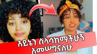 "አይኔ ተስተካክሎልኛል አመሠግናለሁ...እንዴት ላመስግናቹ ቃል አጠረኝ "  ትግስት ከህክምና ስኬት ቡኃላ