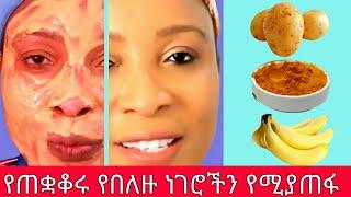 ለፊት ጥራት አስገራሚ የፊት ማስክ | የቤት ውስጥ አሰራር | ልዩ ቀላል ቆንጆና ምርጥ አሰራር | Ethiopian Food Recipe | ቀላልና ጤናማ ምግቦች