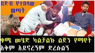 ሁለት እግሩን በጅብ የተበላው ወጣት በፈጣሪ ተዓምር ነው ህይወቴ የተረፈው | Seifu on EBS | Ethiopia | Eyoha Media