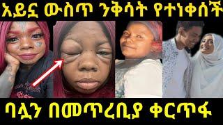 ????አይኗ ውስጥ ንቅሳት የቸነቀሰችው ሴት | ባሏን በመጥረቢያ @seifuonebs @EyohaMedia @AmlesetMuchieactress  ድቅ ልጆች